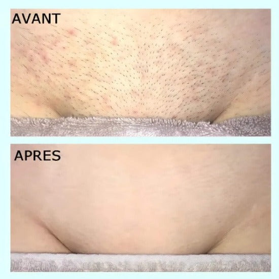 Femme dévoilant une peau lisse grâce à l&